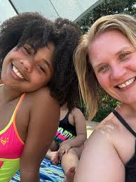 The consequences of skin bleaching