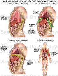 Apr 26, 2018 · for the vast majority of people with left lower back pain, there are safe and natural treatment options available. Anatomy Of Lower Left Abdomen