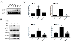Although it has not been tested on humans, the data suggests that a favorable ratio of pge2 to pgd2 has significant hair protective benefits. Ijms Free Full Text Prostaglandin D2 Mediated Dp2 And Akt Signal Regulate The Activation Of Androgen Receptors In Human Dermal Papilla Cells Html