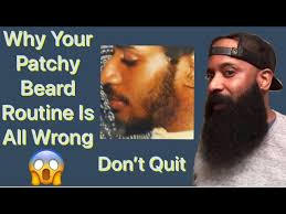 Patchy Beard? No Problem Part 3