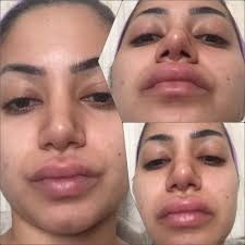 Terrible Experience with Dr Henry Mentz & His Coordinator !!! -...