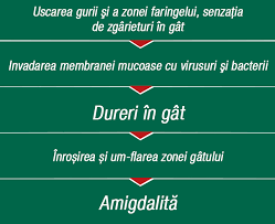 Tratamentul pentru durere in gat poate fi naturist ori pe baza de analgezice eliberate fara reteta. Home