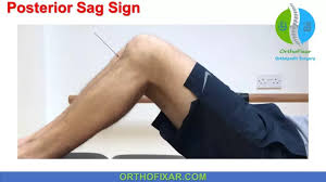 Image result for PCL Sulcus Test