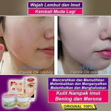Cream dr pure adalah cream pemutih wajah yang mengandung ekstrak sakura, berfungsi melindungi kulit dari sengatan sinar matahari sehingga menjadikan kulit anda tampak lebih putih dan awet muda. Harga Dr Pure Cream Bpom Testimoni Review Dan Perbedaan Asli Dr Pure Cream