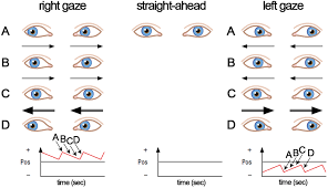Image result for Oculovestibular Testing