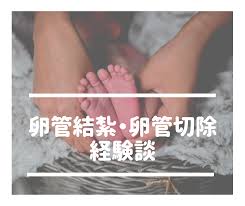 帝王切開時の卵管結紮・卵管切除経験談 | 多胎マム