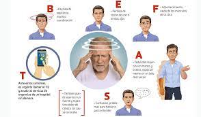 Un ictus se produce cuando un vaso sanguíneo que lleva sangre al cerebro se rompe o bien es taponado por un coágulo u otra partícula. B E F A S T Recuerda Esta Frase Para Reconocer Los Primeros Sintomas De Un Ictus O Infarto Cerebral