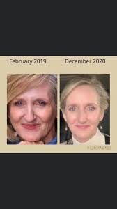 What are your thoughts