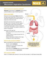 8 Meconium Aspiration Syndrome Ideas Syndrome Aspire Nicu Nurse