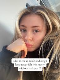 Lash Lift Fail Lashes Falling Out