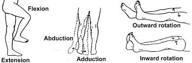 Image result for Femoral Retroversion