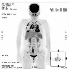 It is not known whether the trigger that initiates the immune disturbance is a foreign substance, chemical, drug, virus, or some other substance. Introduction