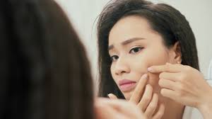 4 cara menghilangkan bekas jerawat secara alami dalam waktu 3 hari jerawat masker wajah buatan rumah produk jerawat. Cara Menghilangkan Jerawat Dengan Skin Care Yang Tepat Kumparan Com