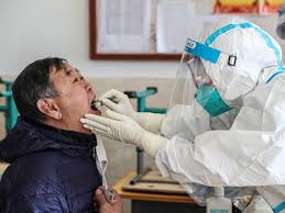 Beide tests werden nur auf voranmeldung durchgeführt. Microbiology Expert China S Plan For Covid 19 Anal Swabs Makes Sense