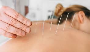 The acupuncture meridians and point locations of the 12 main meridians. Acupuncture Et Fertilite Doctissimo