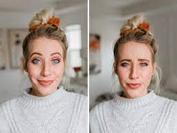 The Truth About Botox How To Not Look Frozen Twist Me Pretty