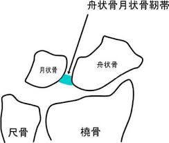 中央部は三角柱状で、上端は上腕骨・尺骨と、下端は手根骨および尺骨とそれぞれ関節をなす。 〔医語類聚（1872）〕 出典 精選版 日本国語大辞典 精選版 日本国語大辞典について 情報 æ‰‹æ ¹éª¨ã®ä¸å®‰å®šæ€§ ã‚«ã‚¤ãƒ­ãƒ—ãƒ©ã‚¯ãƒ†ã‚£ãƒƒã‚¯ã‚¸ãƒ£ãƒ¼ãƒŠãƒ«