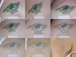 Although lemon juice is used as a bleaching agent, its effect will only work on the top layer of your skin and cannot penetrate beneath that layer to remove tattoo pigments. Natural Home Tattoo Removal Methods Lemon Juice Remove Tattoo