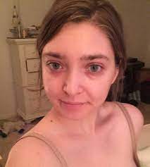 Green tea's active antioxidant, a polyphenol called egcg, is photoprotective and soothing. Skin Concern How Can I Improve My Under Eyes Skincareaddiction