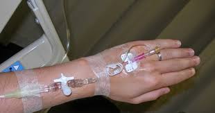 Merk infusion set diantaranya gea, onemed, avico, terumo, otsuka, dll. Cara Cepat Menghitung Tetesan Infus Arga Aditya