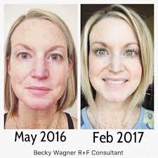 Confidence and glow at 43 without botox or fillers