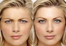 Image result