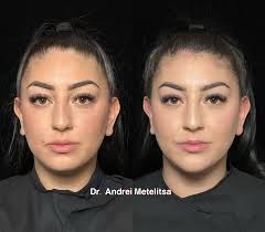 It's all about the lower face 😊