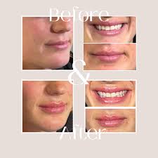 We are so excited to announce that "We've Been Nominated for 2024 Best of  the Best" 🎊❤️🎉 We appreciate Every Vote and we thank you for your  support. Voting is open until