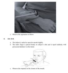 Image result for Supinator Reflex