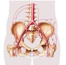 Leriche Syndrome Aortoiliac Occlusive Disease Causes Symptoms Diagnosis And Treatment