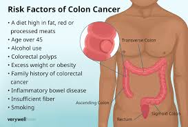 Image result for Constipation in Cancer