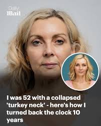 What a transformation 👏 Read more: https://trib.al/kc1l4rH