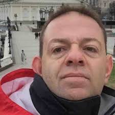 🧲 Magnetic anastomosis