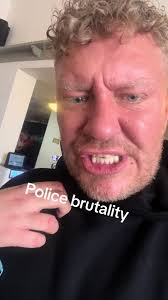 Complaint Against GMP: Addressing Police Brutality