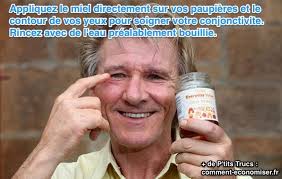 Epingle Sur Remedes Naturels