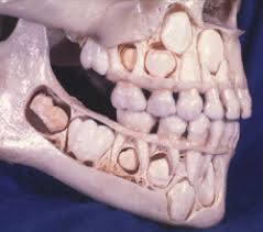 Image result for Dentition
