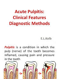 Image result for Pulpitis