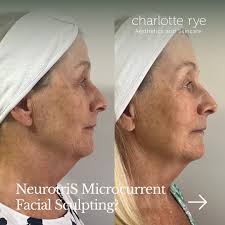 Charlotte Rye (@charlotteryeskin) · Meopham