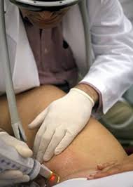 As we have stated before, the genitals are a particularly sensitive area of the body. Male Laser Pubic Hair Removal Guide Ogden Skin Care Center