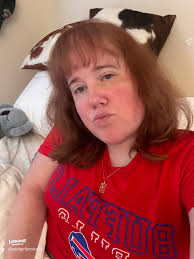 Key Insights from BFRB Support Group Meetings