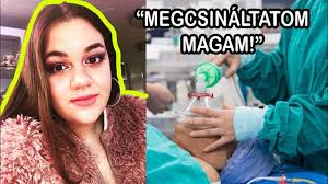 Gáspár virág fél éve volt együtt párjával, amikor fogyókúrázni kezdett. Gaspar Virag Plasztikaztatni Szeretne Youtube