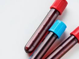 Even though many cancer patients have this mutant dna in detectable amounts in blood, liquid biopsies will probably not be enough to detect all can all types of cancer show up in a complete work up? Thrive Flourishes Raises 257m To Carry Forward Its Cancer Seeking Blood Test Fiercebiotech