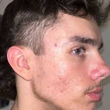 Malachi Patrick John Stanley punched transgender man in Surfers Paradise