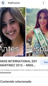 𝗦𝗨𝗣𝗘𝗥 𝗕𝗘𝗔𝗨𝗧𝗬