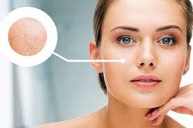 Cách chăm sóc da thiếu nước, thiếu ẩm hiệu quả