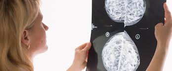 Common areas where you might notice swollen lymph nodes include your neck, under your chin, in your. Swollen Lymph Nodes And The Covid 19 Vaccine What To Know