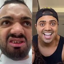 Mc kelvinho e mc dimenor. 6 Famosos Que Trocaram Seus Dentes Naturais Por Lentes De Contato
