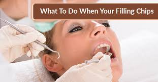 A filling is more easily performed on a tooth with less decay, which can help shorten the recovery process so you can begin eating the foods you want sooner. What To Do When Your Filling Chips David Silberman Dds