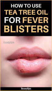 How To Get Rid Of Fever Blisters Using Tea Tree Oil Fever Blister Blister On Lip Tea Tree Oil