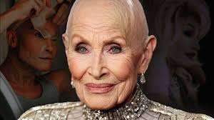 Dolly Parton Tried to Keep Her Disease a Secret, Now We Know Check the  comments